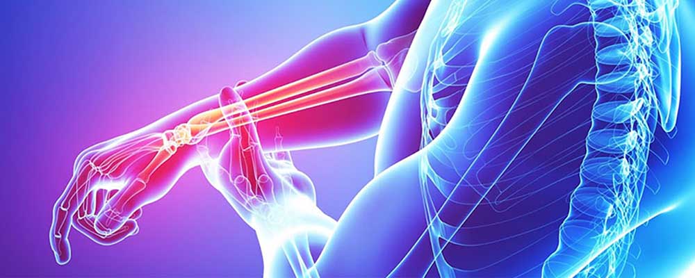 روش شکسته بندی