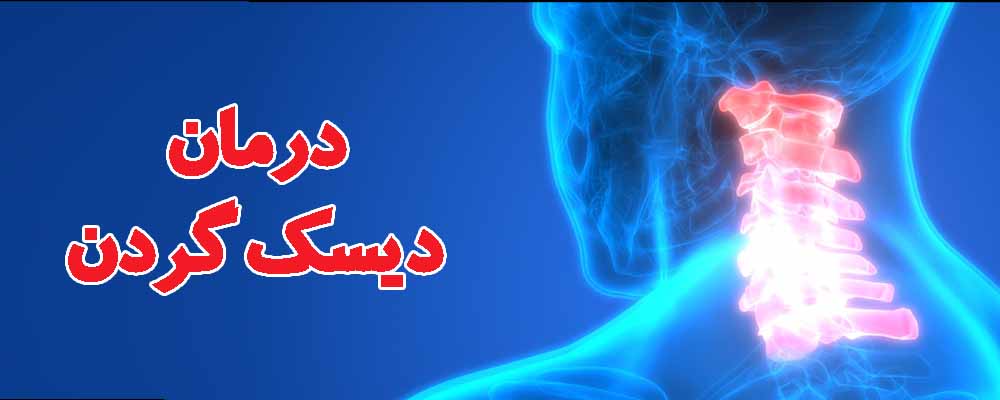درمان خانگی دیسک گردن
