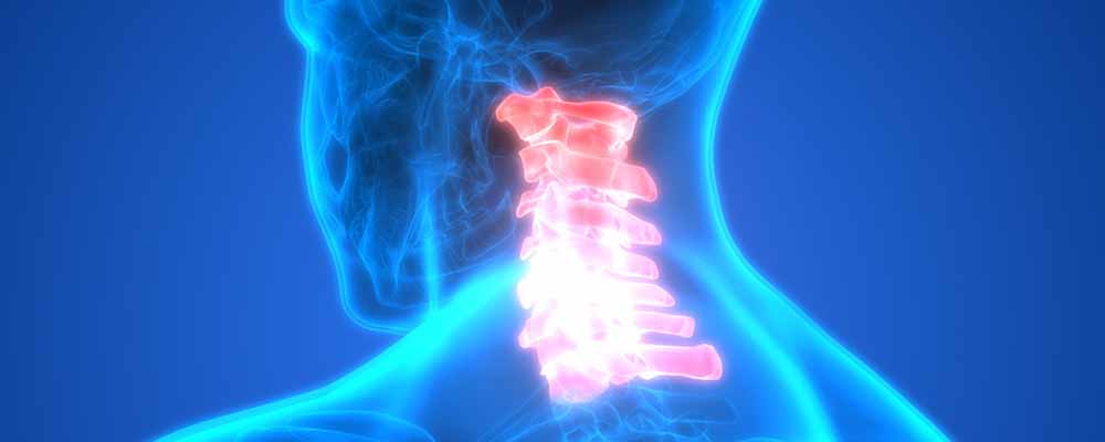 درمان سریع دیسک گردن