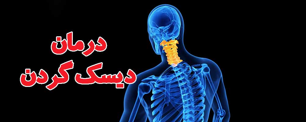 درمان دیسک گردن بدون جراحی